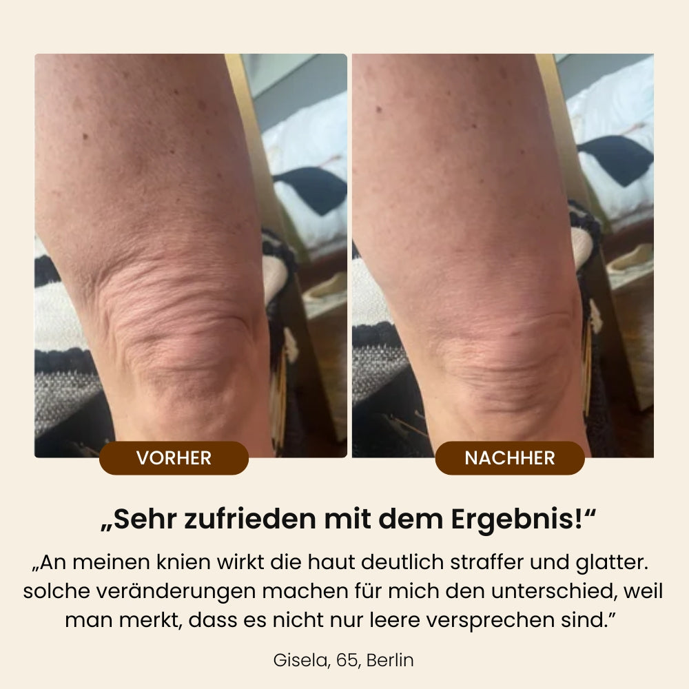 Besque® Magic Körperöl – 100 ml