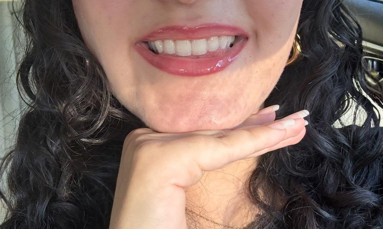 Špela B, 38