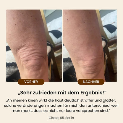 DRMTLGY Retinol-Körperlotion