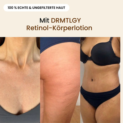 DRMTLGY Retinol-Körperlotion