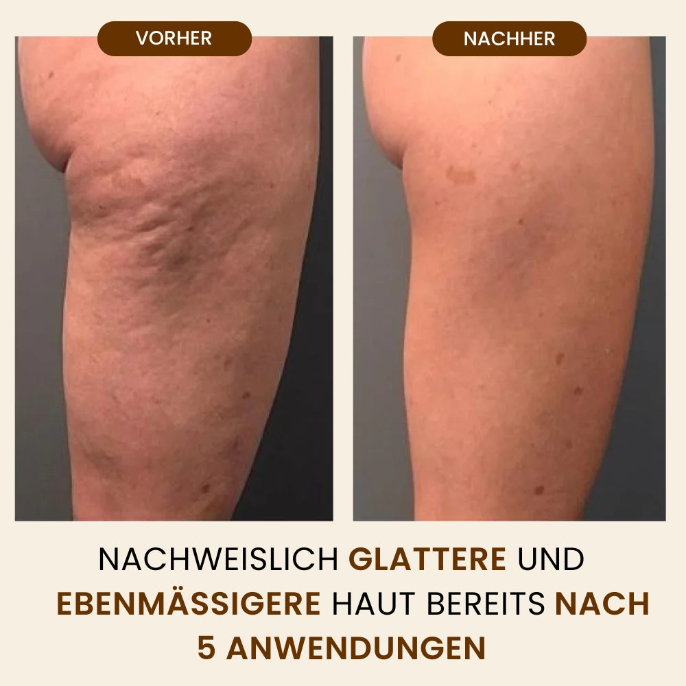 DRMTLGY Retinol-Körperlotion