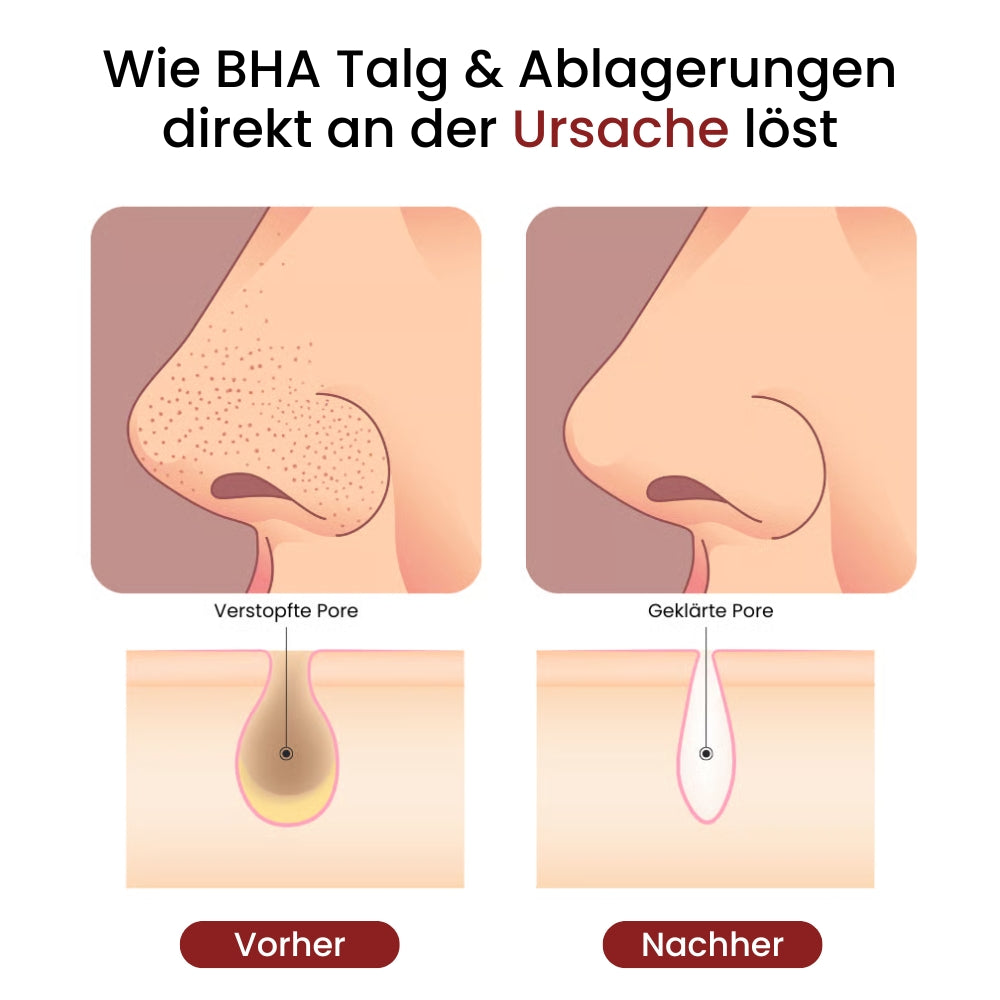 BHA Koreanische Peel Shot – Sichtbar reinere Poren nach nur einer Anwendung