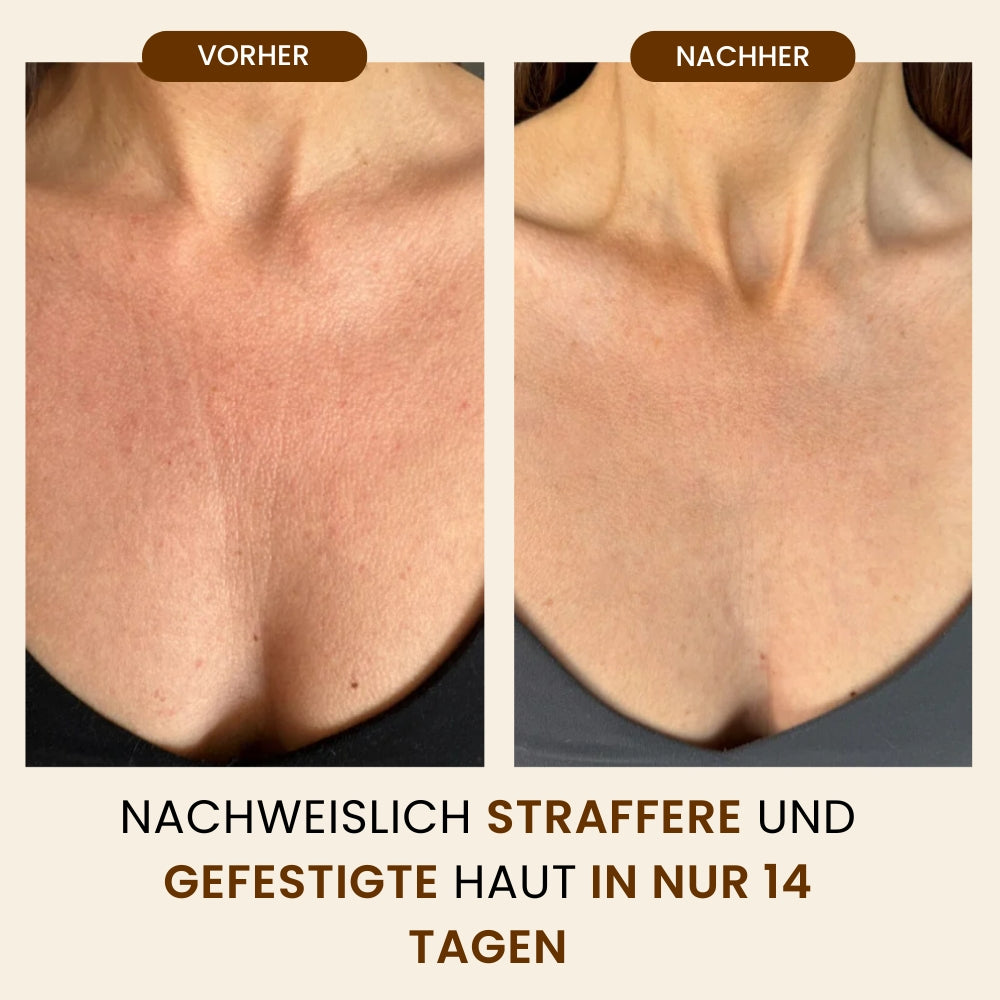 DRMTLGY Retinol-Körperlotion