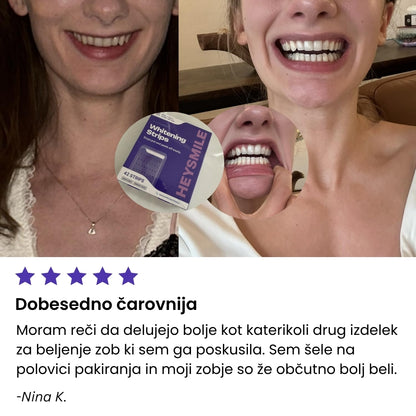 Vijolčni Belilni Traki za Občutljive Zobe