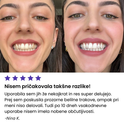 Vijolčni Belilni Traki za Občutljive Zobe