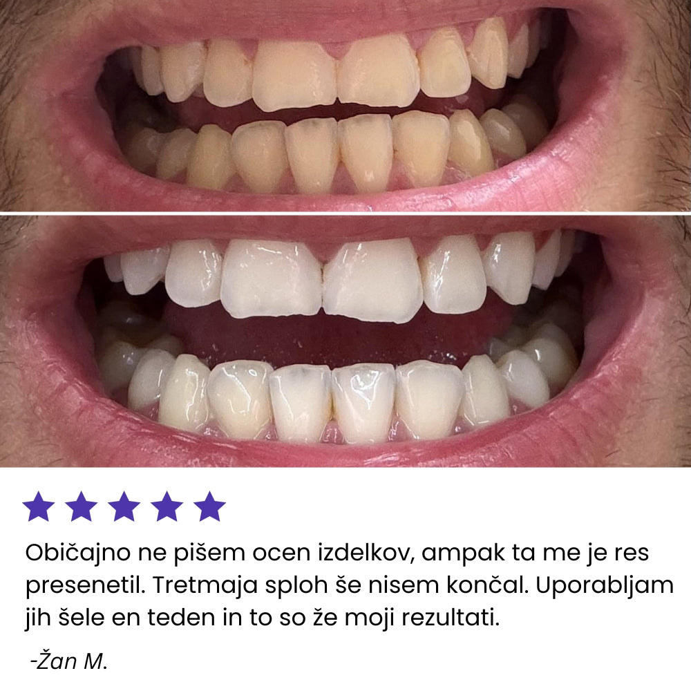 Vijolčni Belilni Traki za Občutljive Zobe
