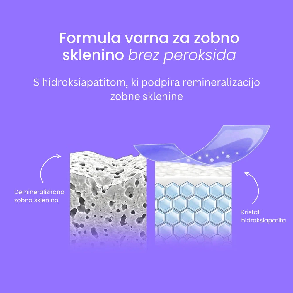 Vijolčni Belilni Traki za Občutljive Zobe