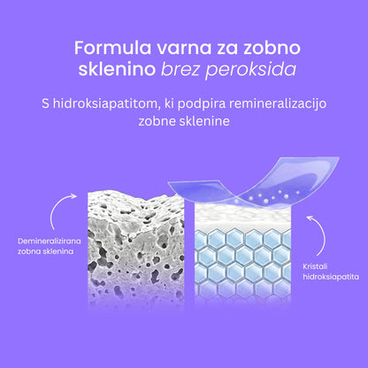 Vijolčni Belilni Traki za Občutljive Zobe