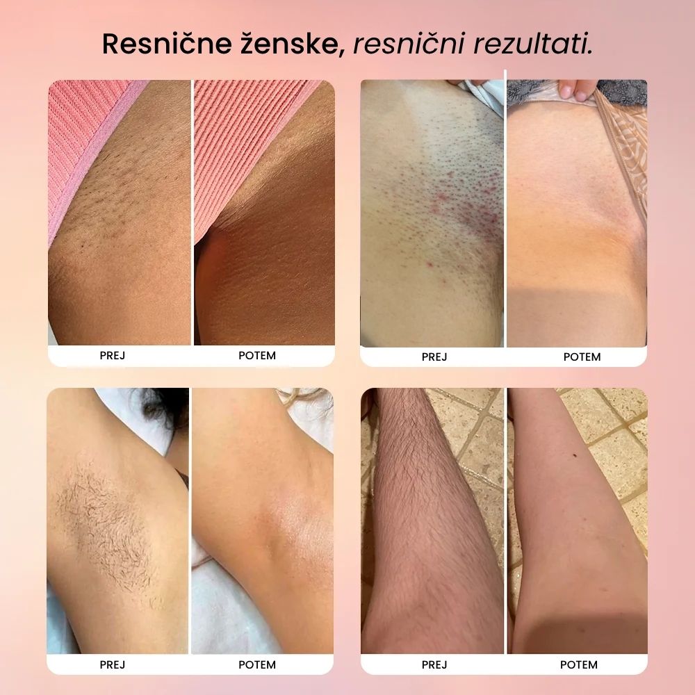 LadyShaver - 2v1 Električni Bikini Brivnik